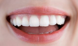 Close-up of Nice White Teeth — Cosmetic Dentistry in Hemet, CA