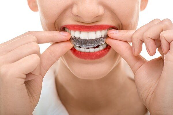 Wearing Orthodontic Silicone Trainer - Cosmetic Dentistry in Hemet, CA