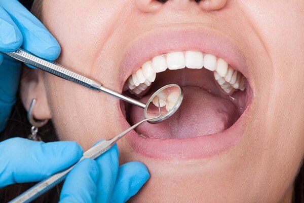 Tooth Check Up - Cosmetic Dentistry in Hemet, CA