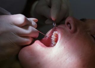 Patient at dental hygienists office - Periodontics in Hemet, CA