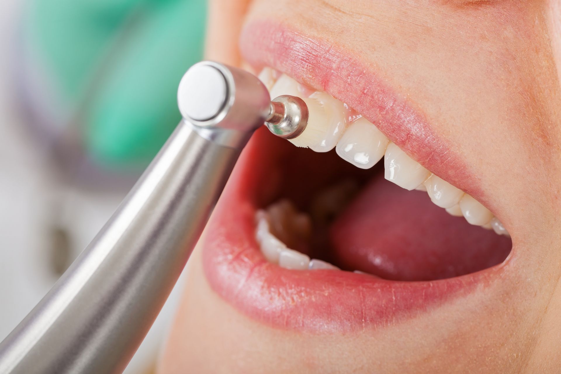 A woman is getting her teeth cleaned by a dentist.