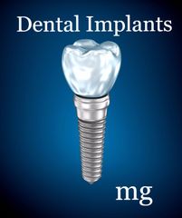 Dental Implants in Bristol with Dr Mark Gillis