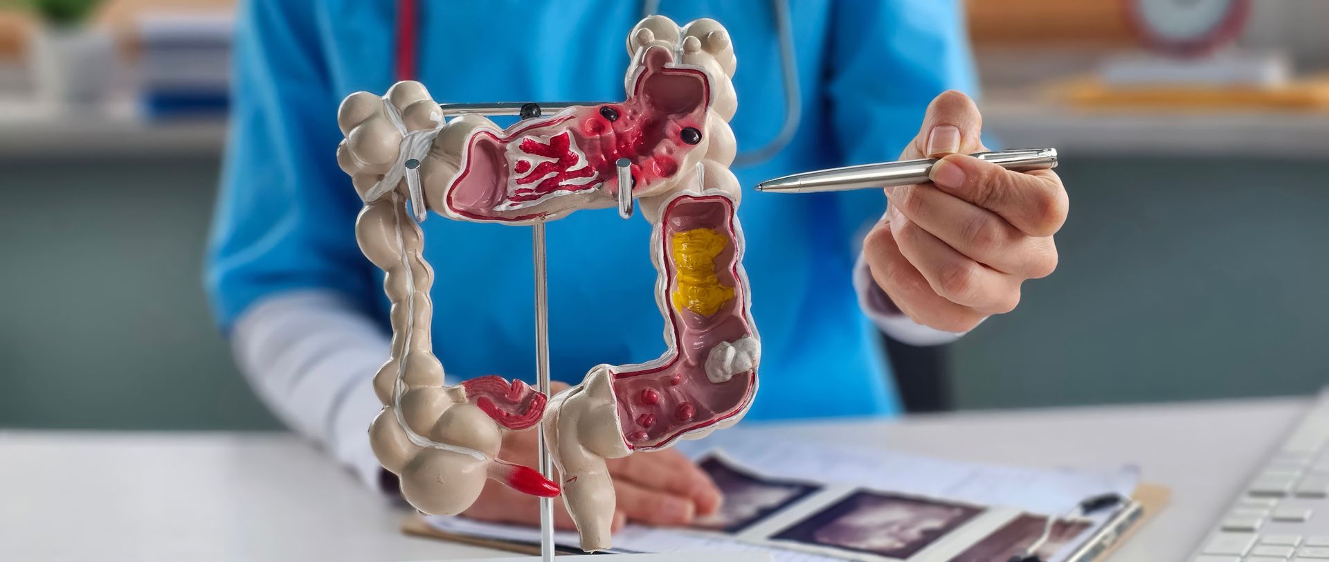 adenocarcinoma gástrico