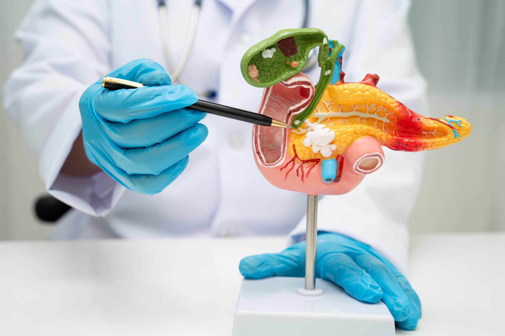 pancreatectomia