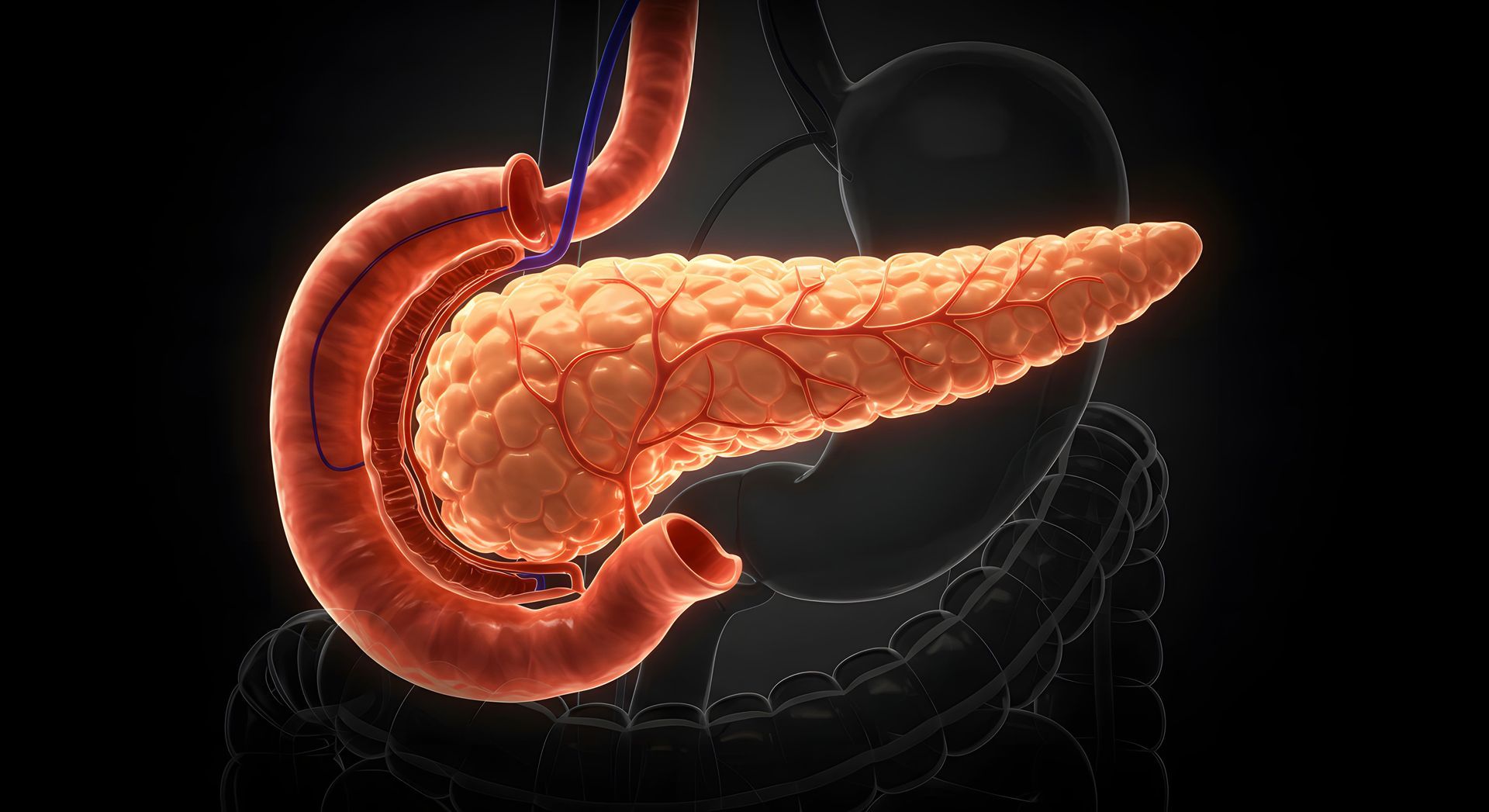pancreatite crônica
