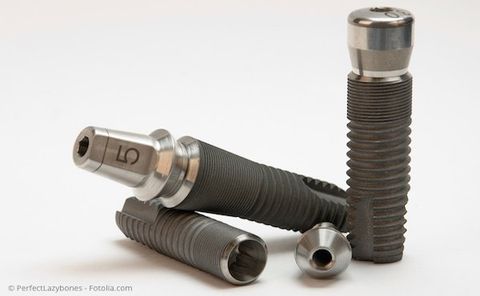 Die meisten der heute verwendeten Implantate bestehen aus dem Metall Titan. Es gibt aber auch Implantate aus Keramik.