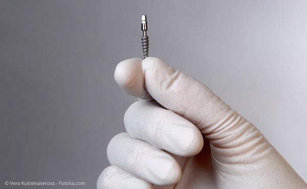 © Vera Kuttelvaserova - Fotolia.com