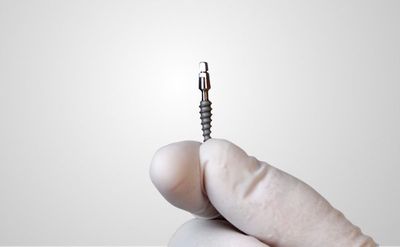 Mini-Implantat für schonende Behandlung