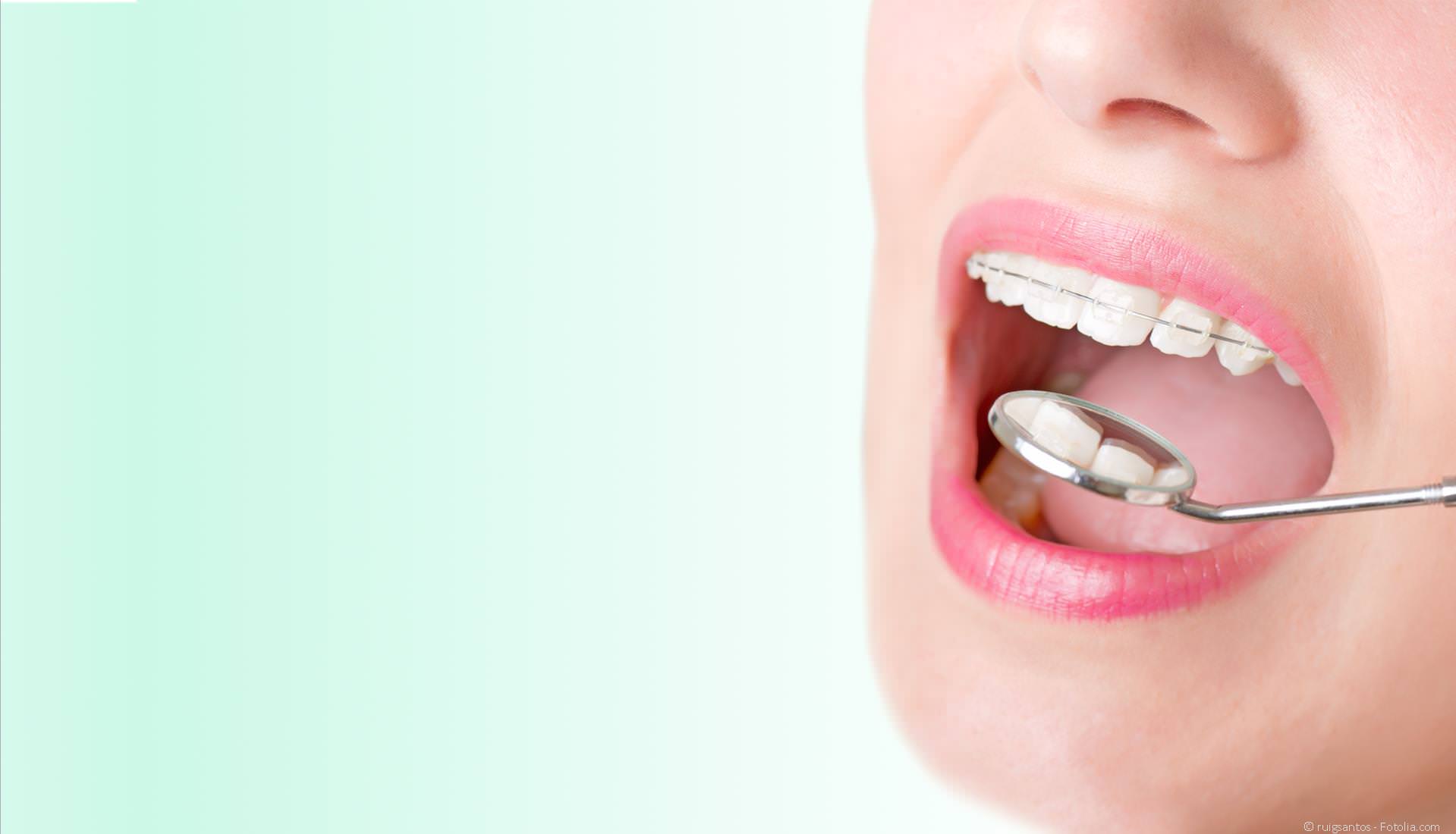 Kieferorthopädie (KFO) Sulzbach