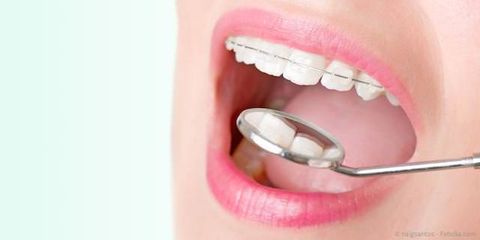 Zahnregulierung mit Kieferorthopädie (KFO)