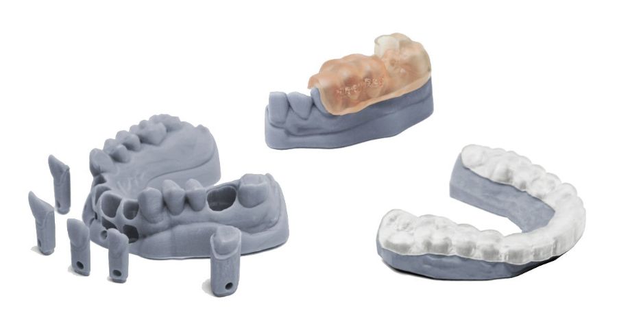 protesi dentali realizzate con tecnologia 3D