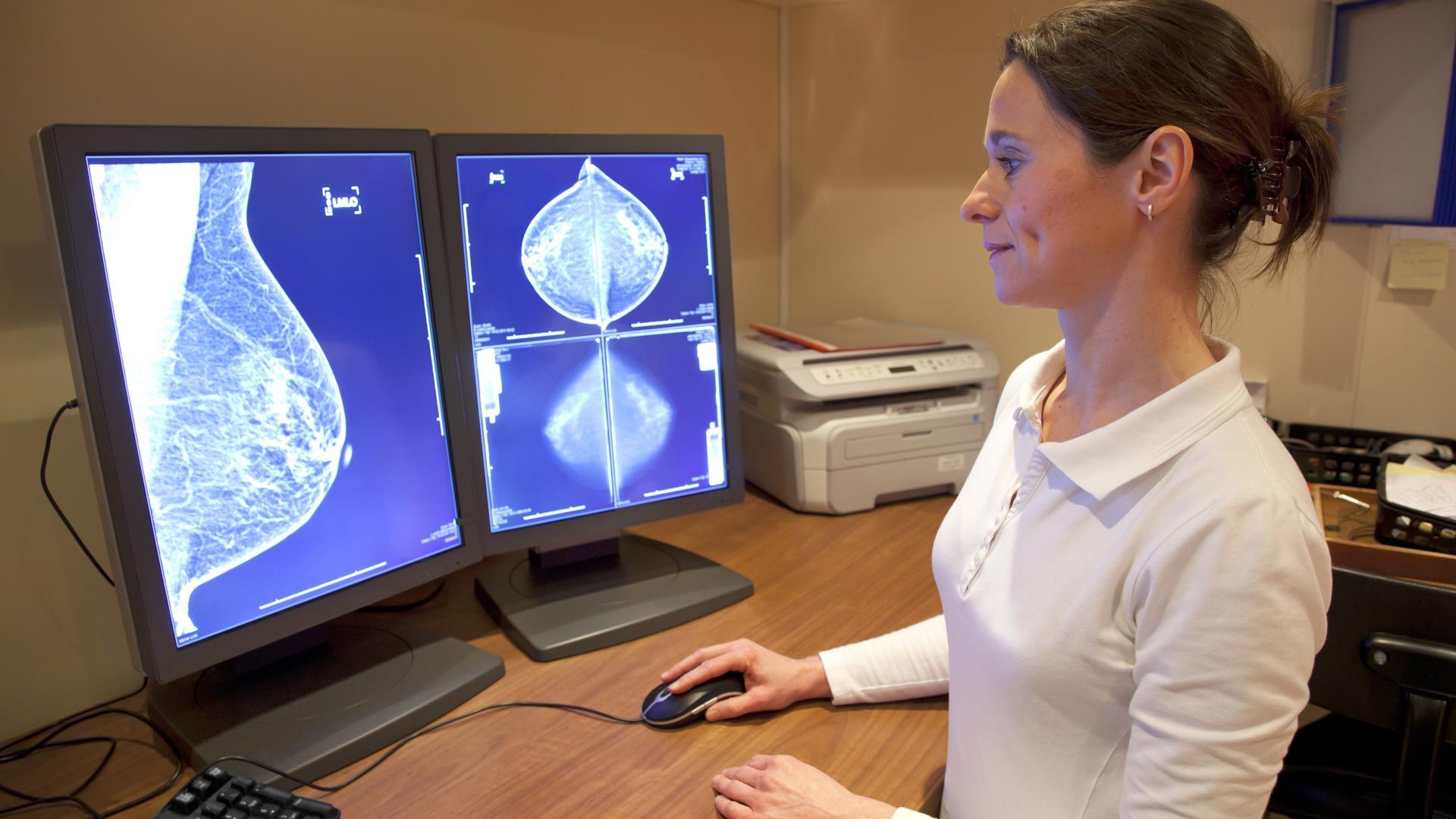 A woman is looking at a breast scan on a computer screen