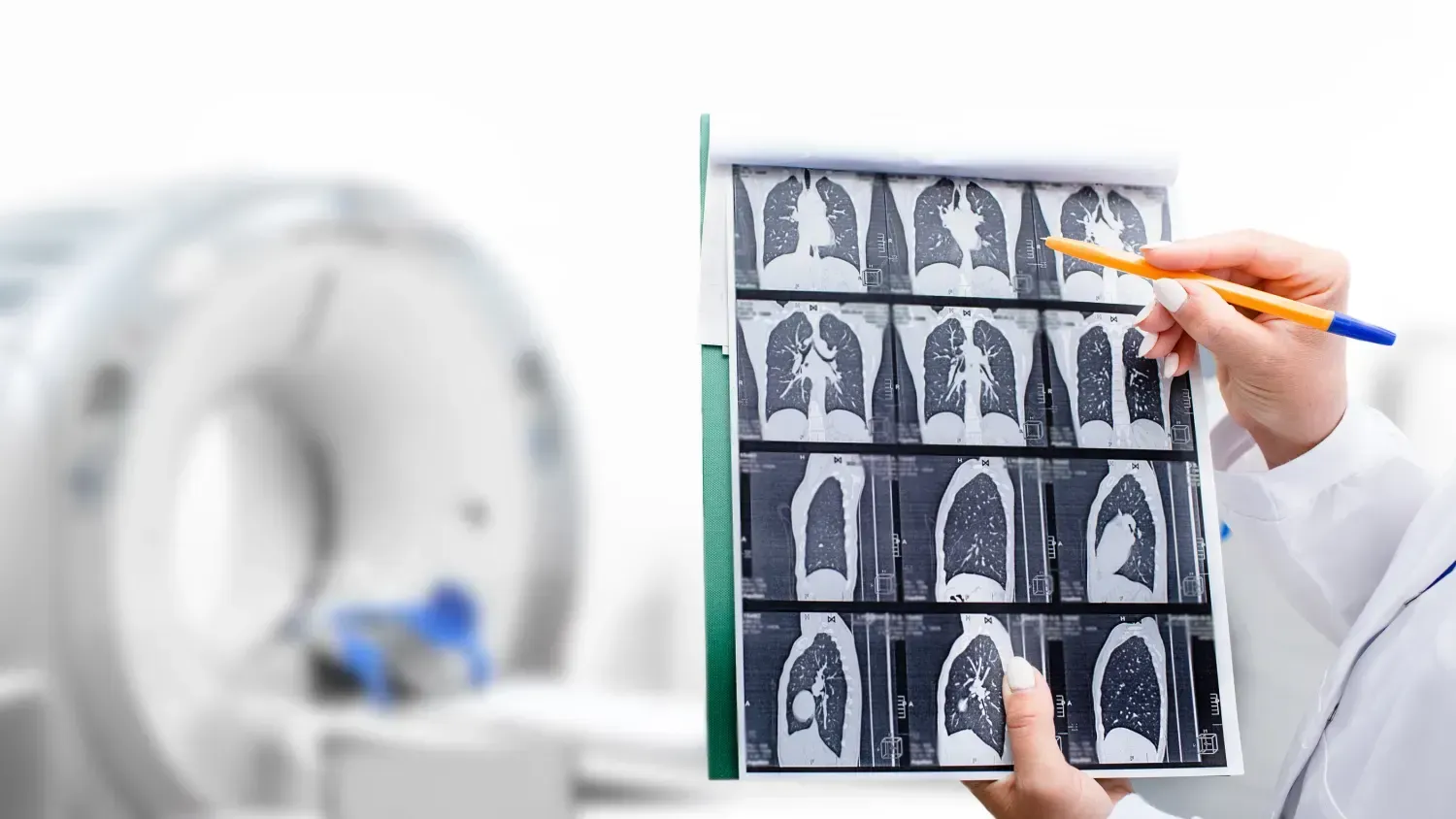 A doctor is holding a ct scan of a patient 's lungs.