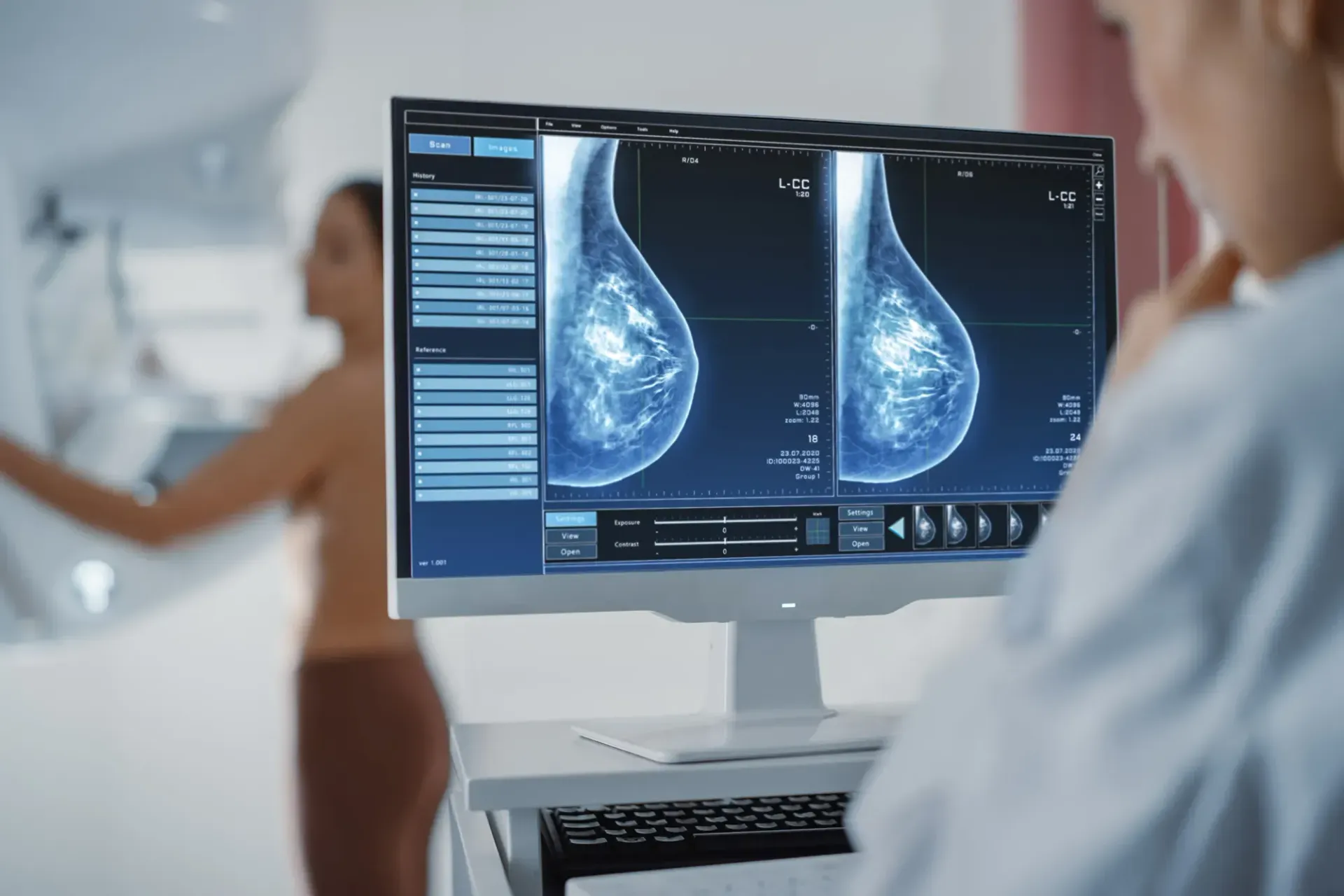 A doctor is looking at a breast scan on a computer screen.