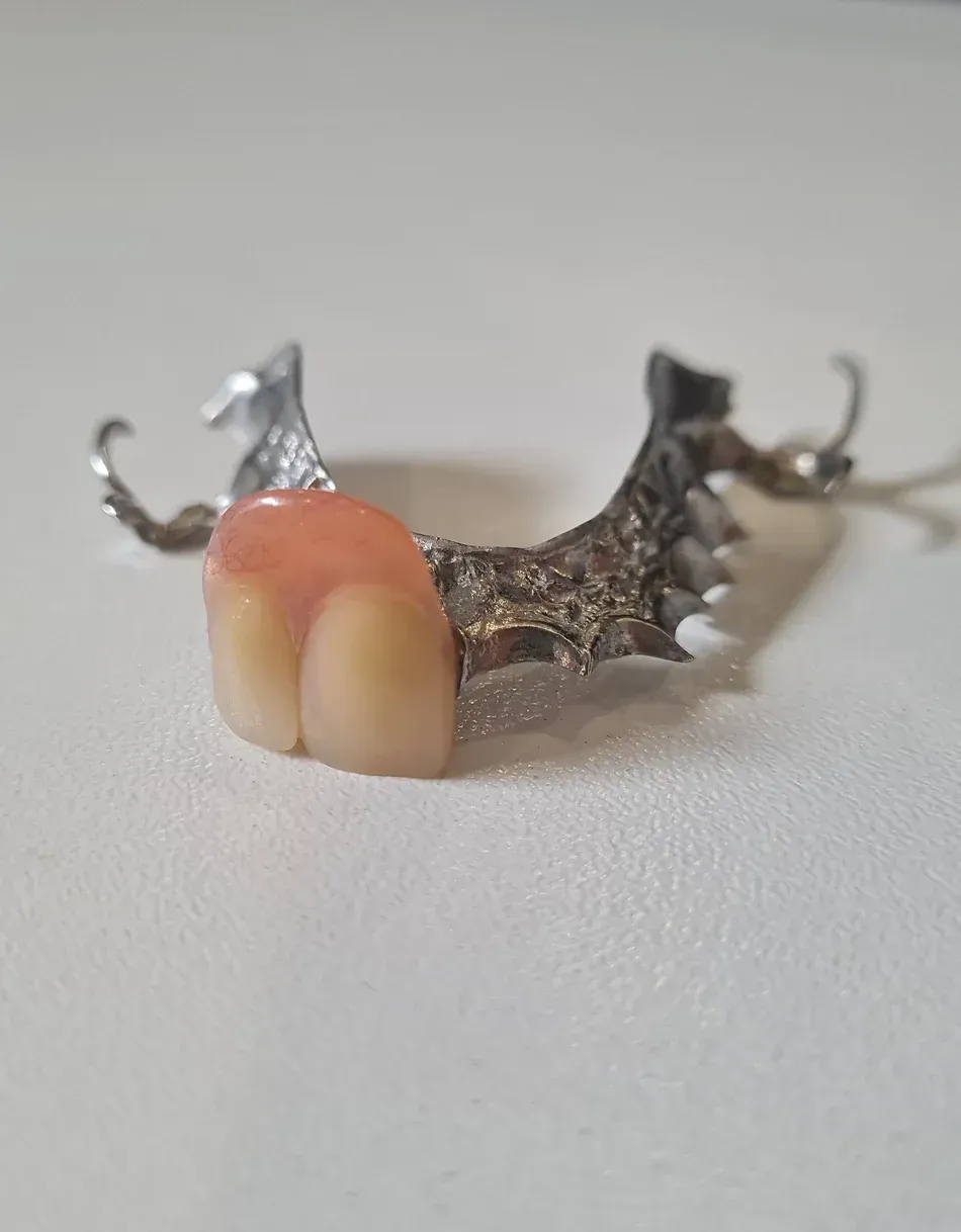 A Close-Up of a Denture on a White Surface | Lismore, NSW | Active Denture Clinic