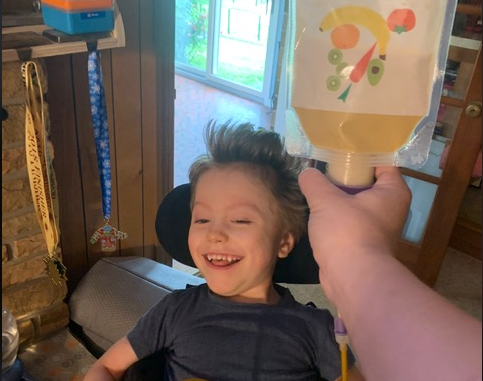 A child holding the Bolee Bag and Bolink Large Cap while being tube fed