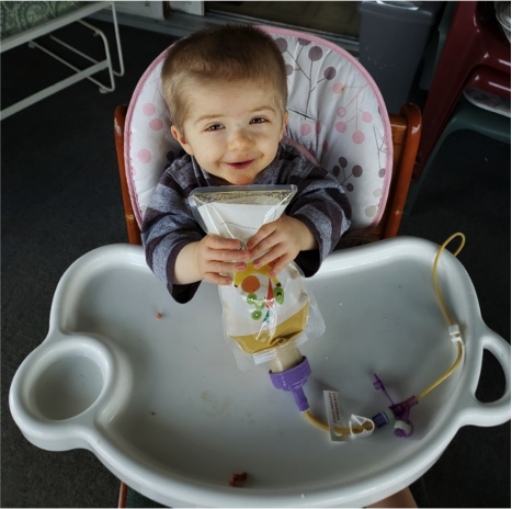 Young person holding the Bolee Bag while tube feeding