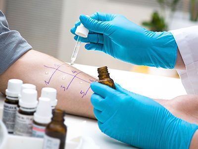 DR. LUIS GÓMEZ REZA - ALERGIAS