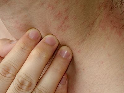 DR. LUIS GÓMEZ REZA - PIEL