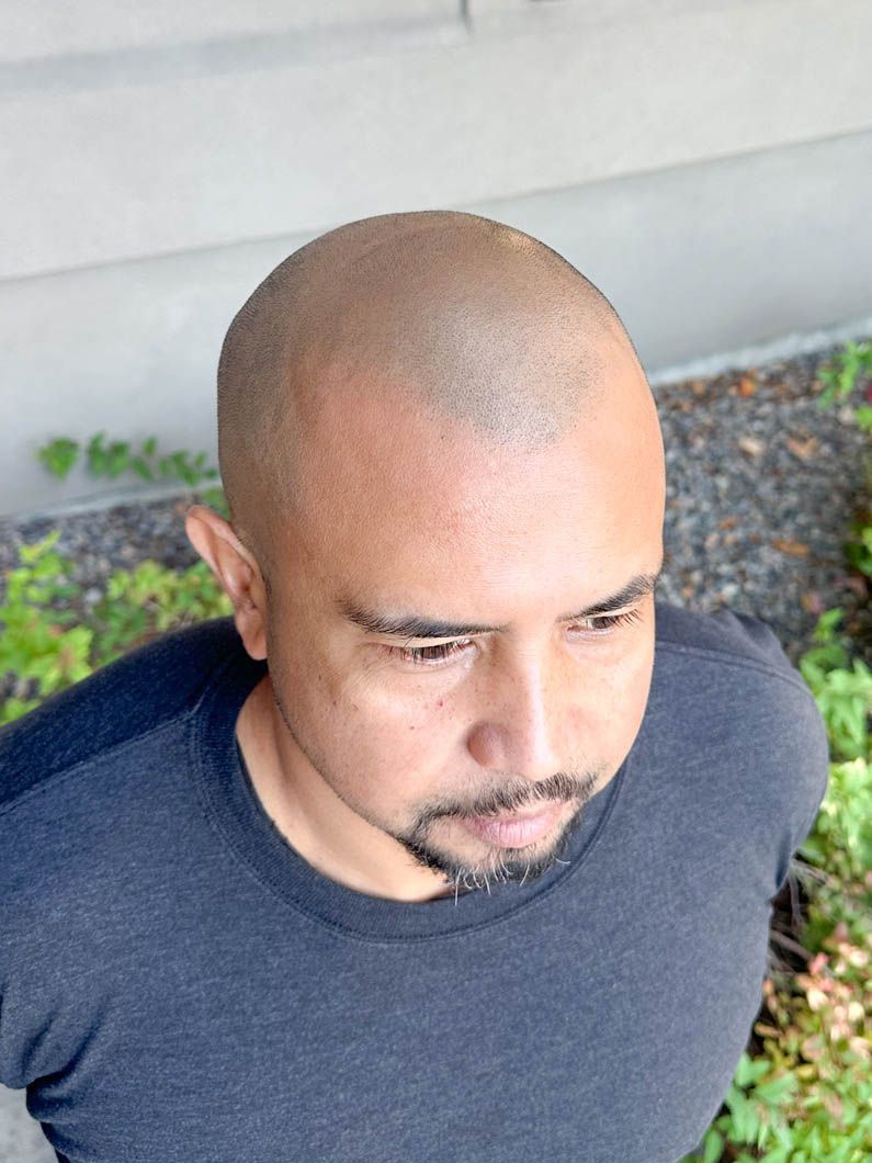 a man with a shaved head and a beard is wearing a black shirt .