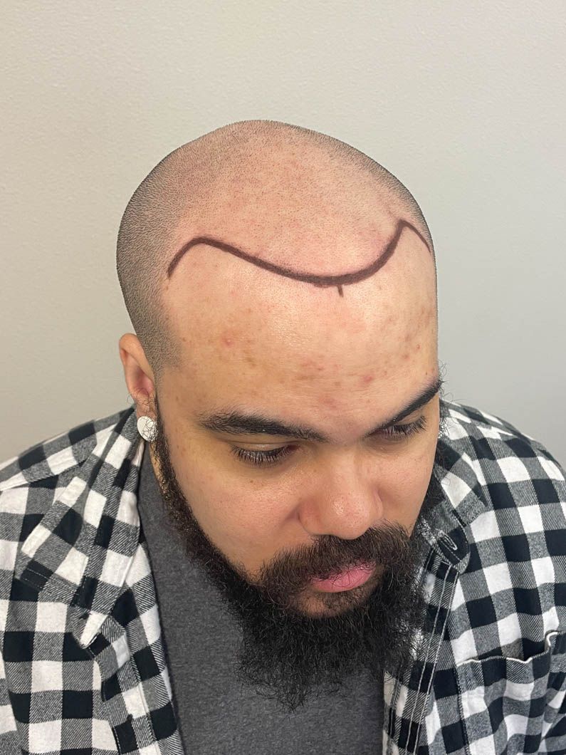 a man with a beard has a drawing on his head .