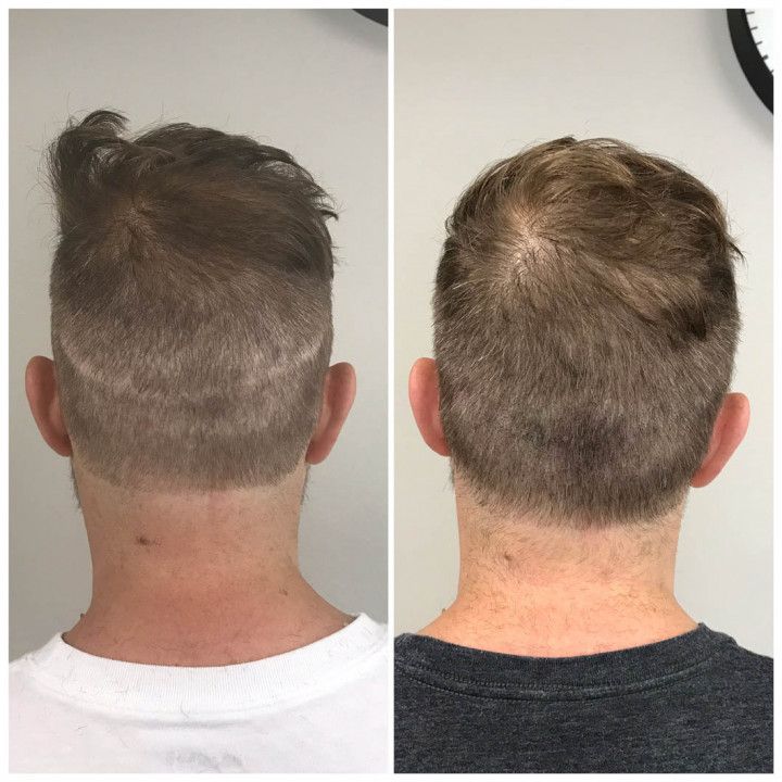 a before and after picture of a man 's hair
