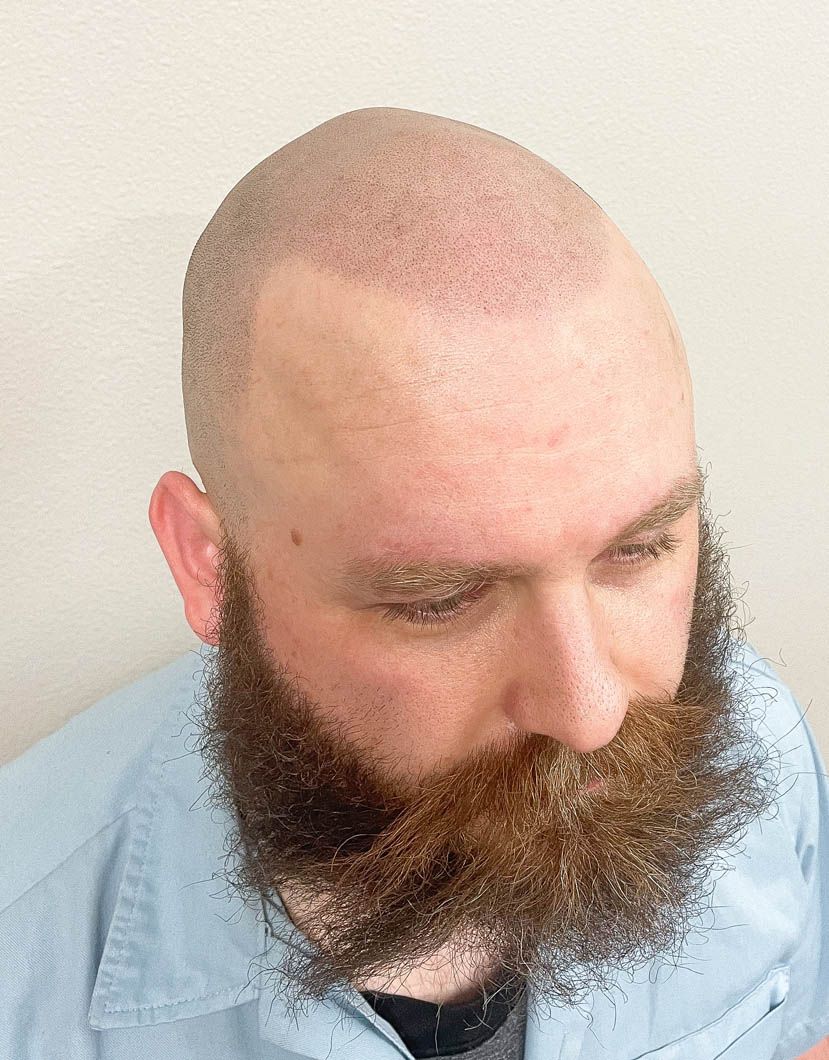 a man with a beard and a bald head is wearing a blue shirt .