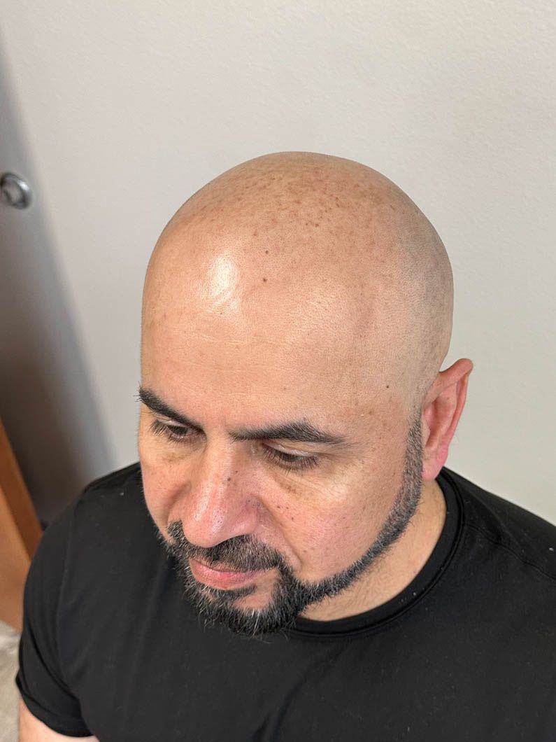 a bald man with a beard is wearing a black shirt