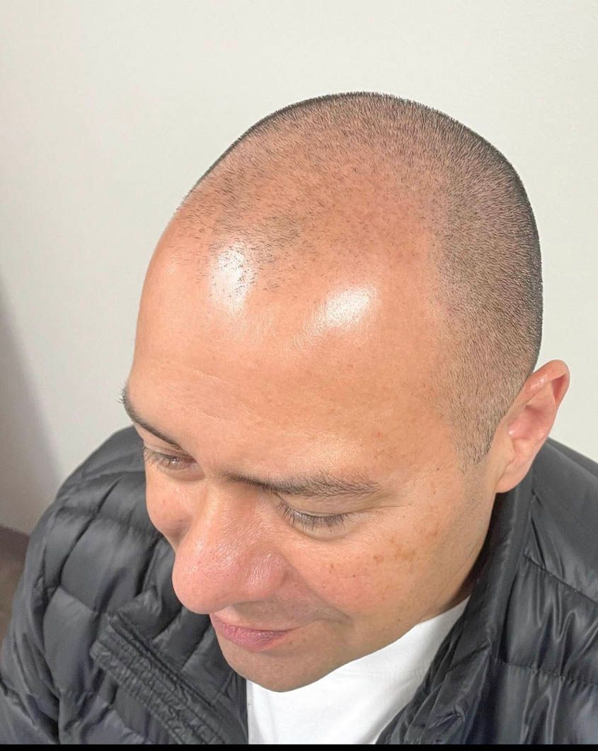 a man with a shaved head is wearing a black jacket