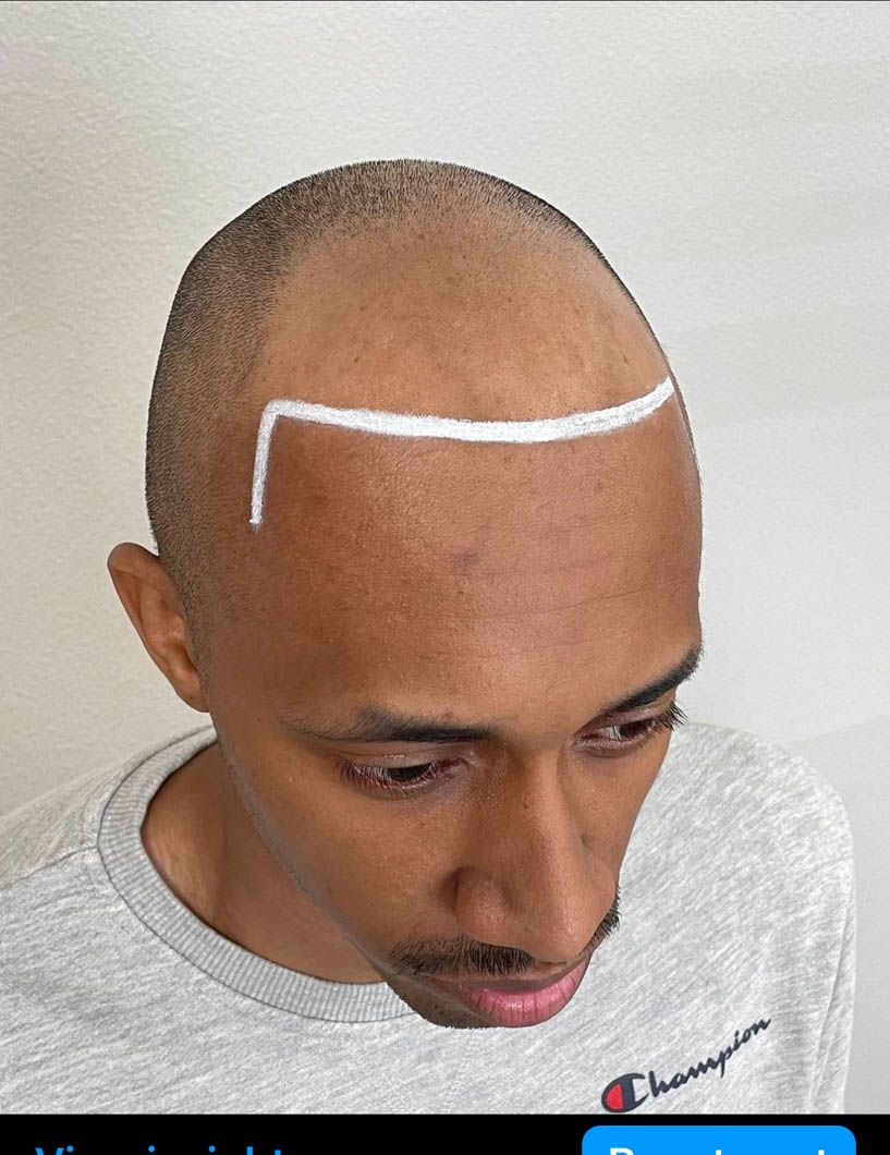 a man with a white line drawn on his head