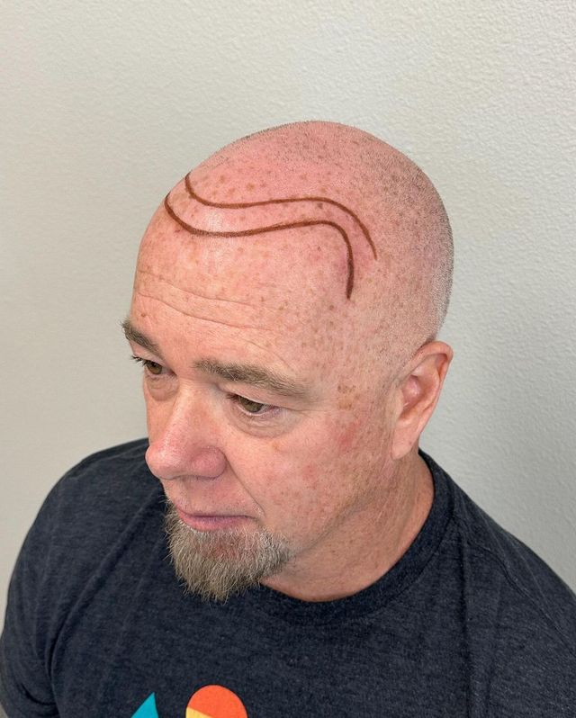 A person with a shaved head has a wavy, reddish-brown double-line tattoo drawn across their forehead and scalp.