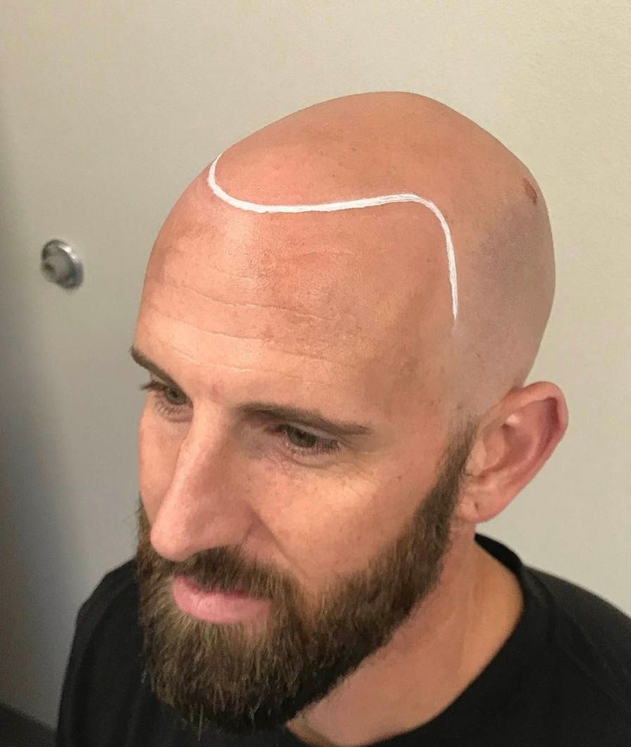 a bald man with a beard has a white line drawn on his head