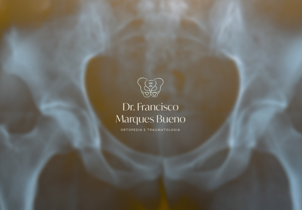 Uma radiografia de uma pélvis com o nome dr. Francisco Marques Bueno