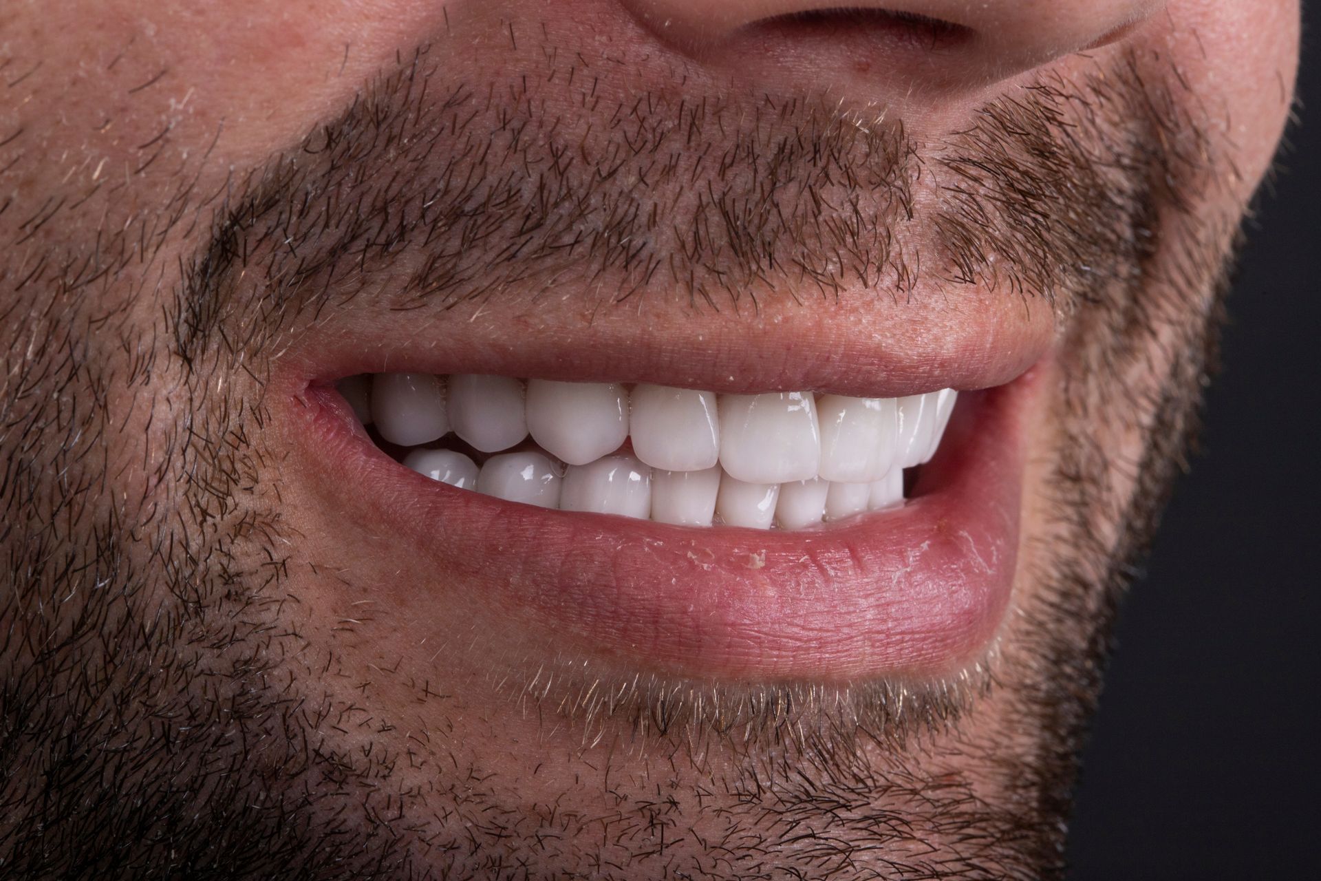 A close up of a man 's mouth with a beard and white teeth.