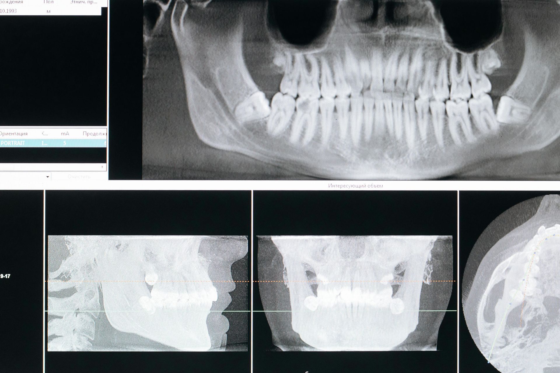 Elevate Your Dental Care Introducing CBCT Scanning at Westlake Dental Care