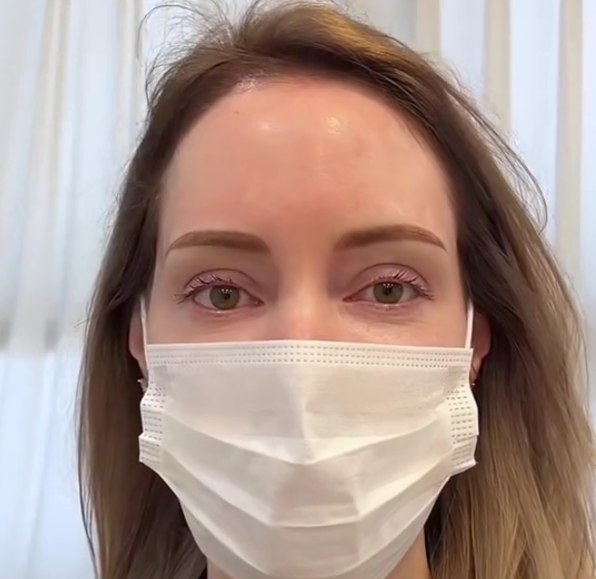 Person covering eyes with hands; neutral expression.