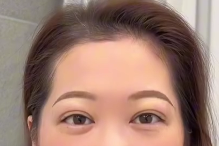 Person covering eyes with hands; neutral expression.