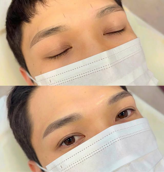 Eyebrow enhancement procedure: before and after shots, showing filled-in brows on a person with dark hair, wearing a face mask.