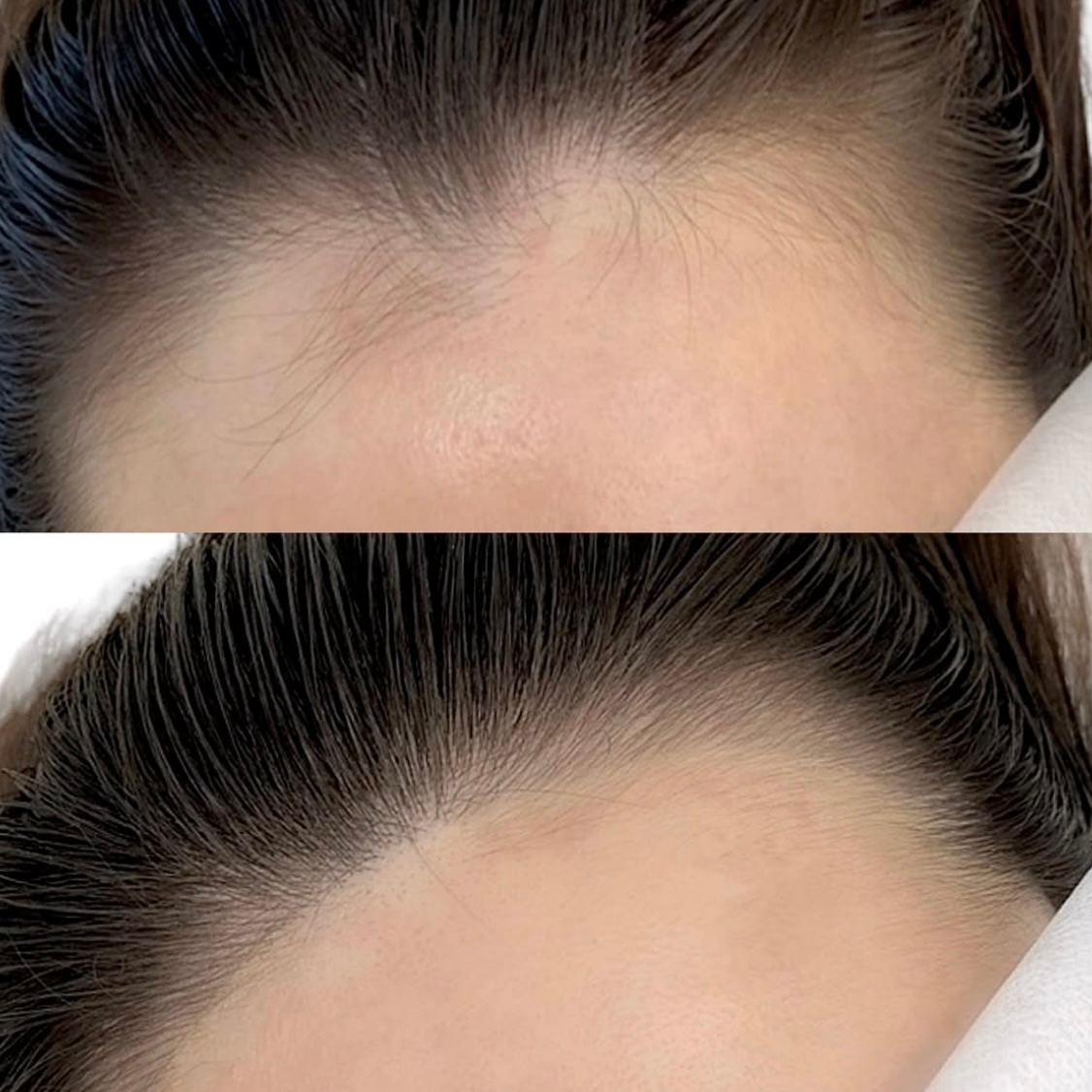 Woman wearing a white face mask, brown eyes, and dark eyebrows, lying down.