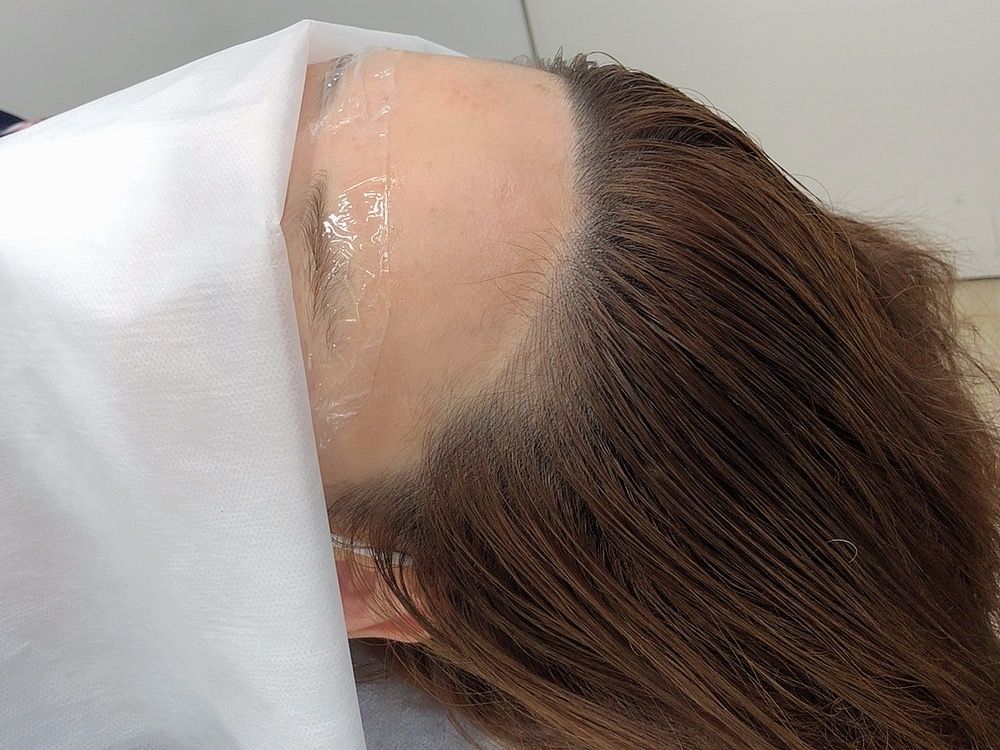 Woman with rosy cheeks, smiling, showcasing lip color transformation: before and after.