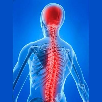 NEURÓLOGO JERÓNIMO RODRÍGUEZ RODRÍGUEZ - EMBOLIA