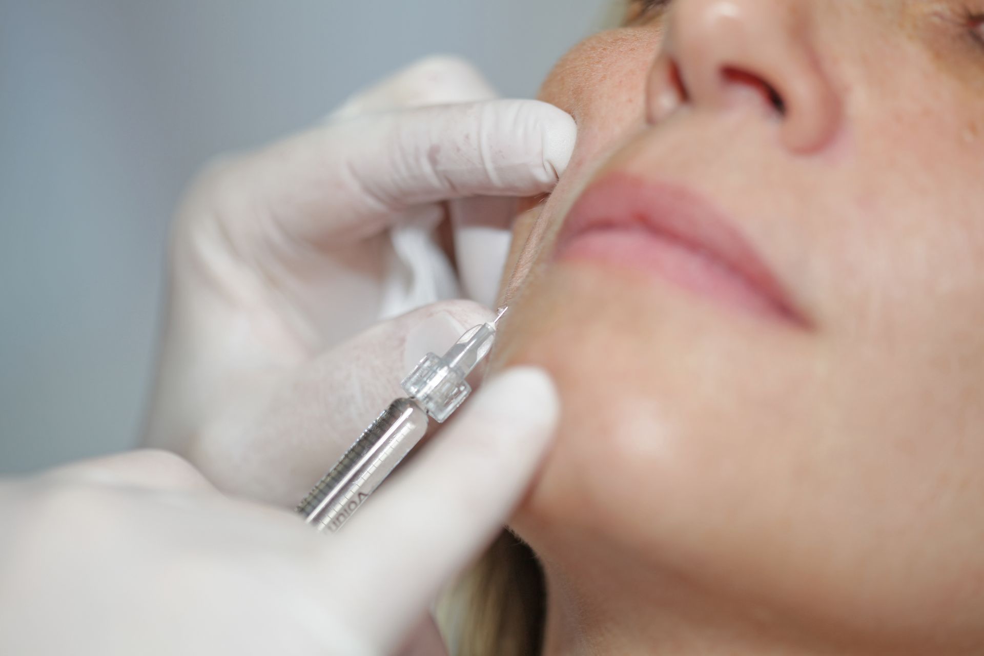 Eine Frau bekommt eine Botox-Injektion ins Gesicht.