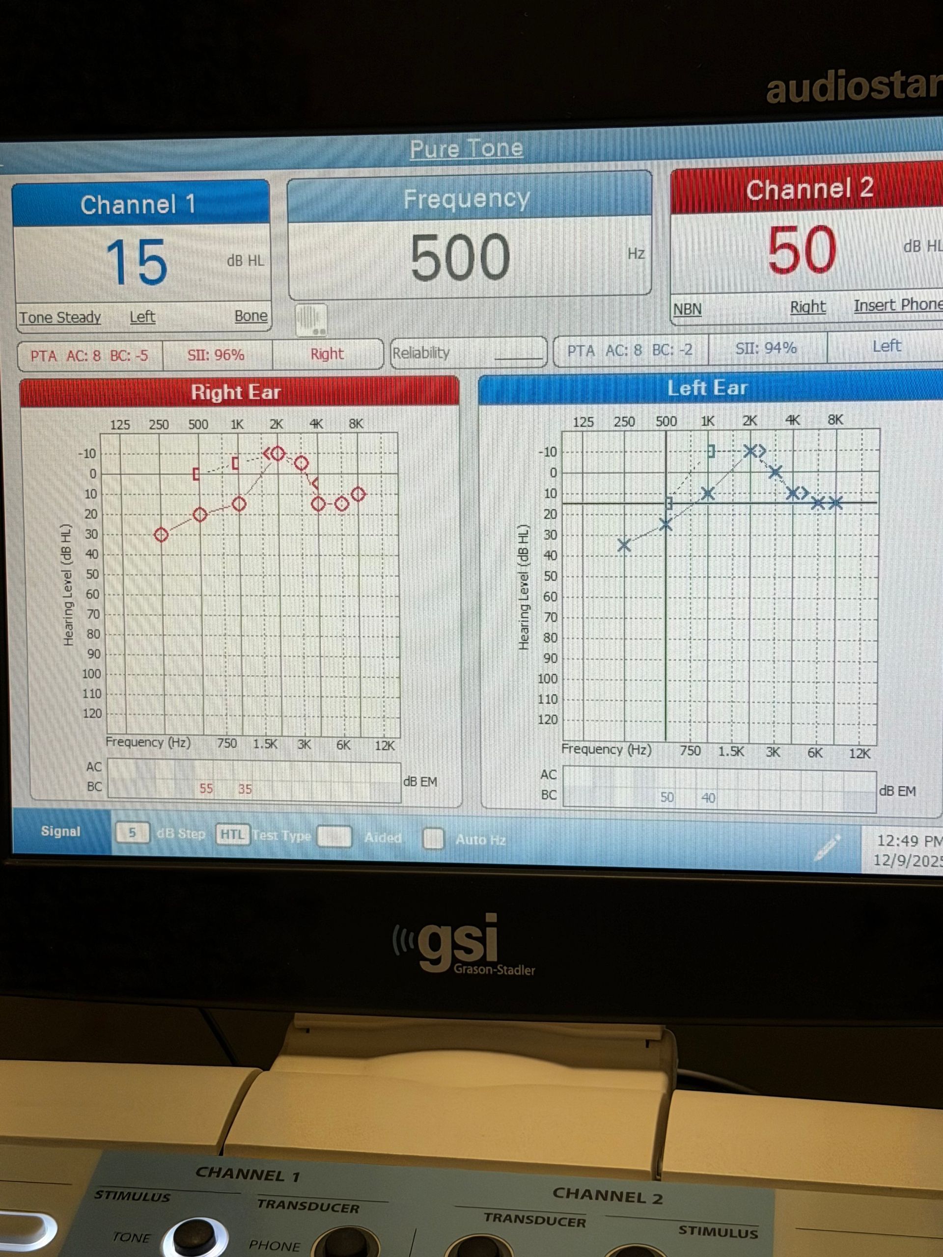 Screen displaying audiogram data for right and left ears, with frequency and intensity values.