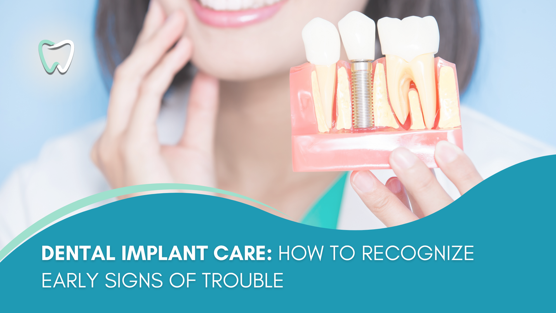Person holding a dental implant model, smiling, with title: Dental Implant Care: Early Signs of Trouble.
