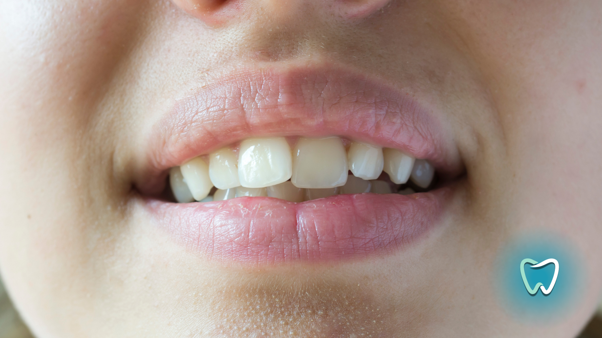 Close-up of a person's slightly open mouth showing white teeth and pink lips.