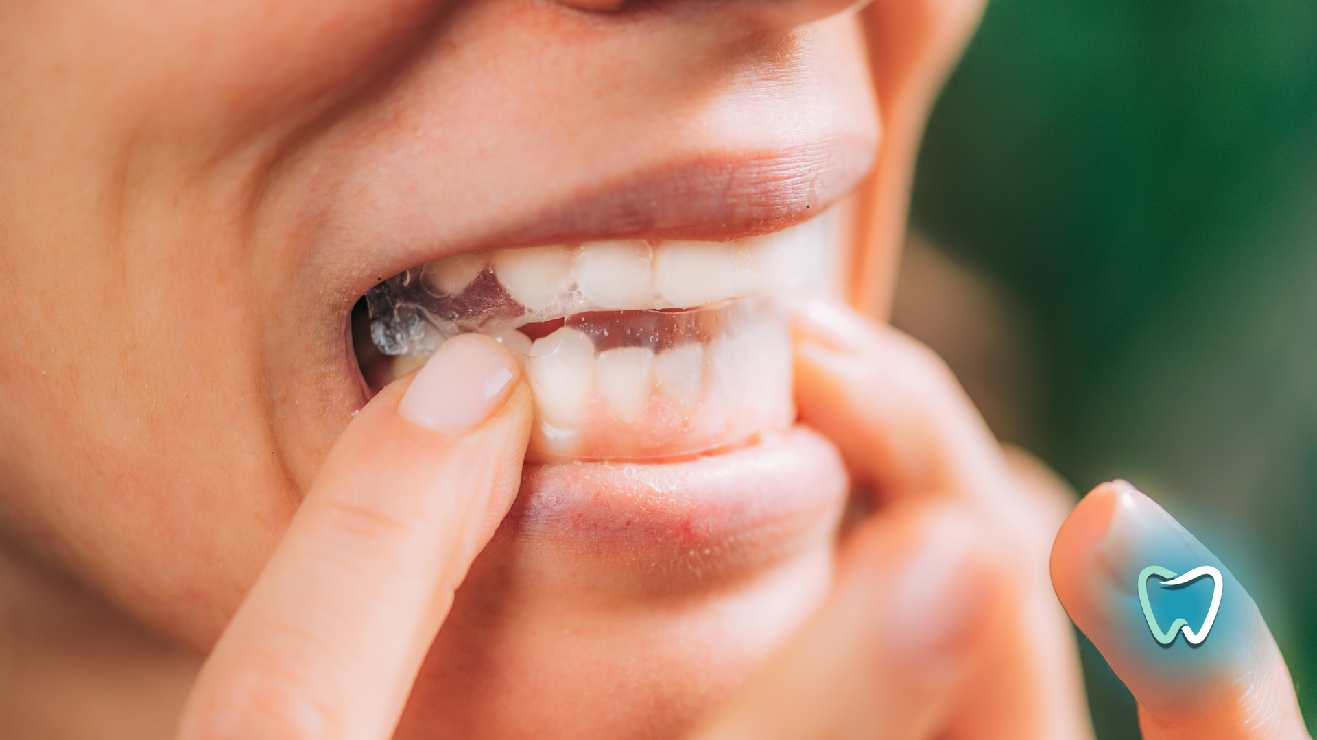 A woman is putting a clear brace on her teeth.