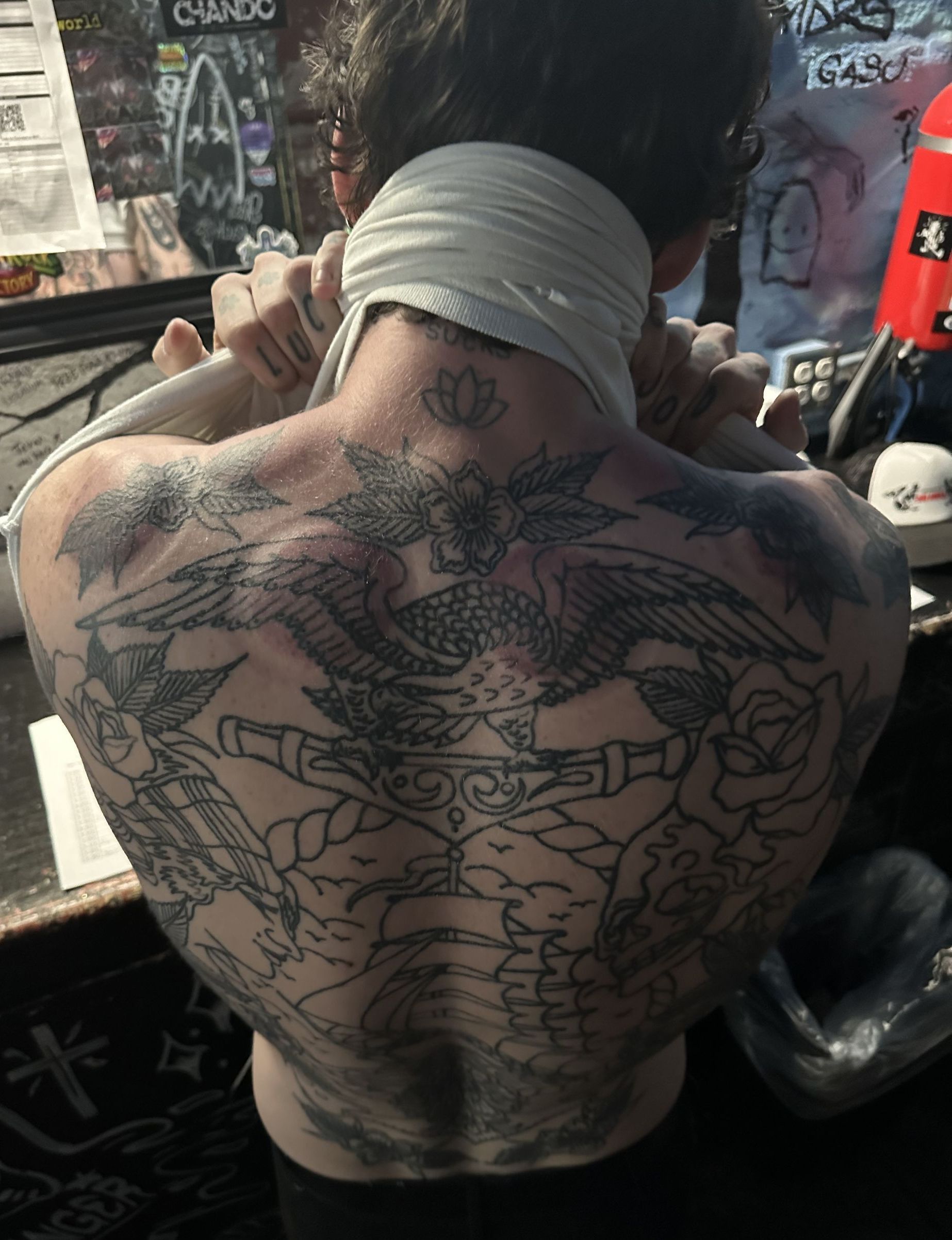 Sage Weber, a drummer for the band Point North after getting cupping therapy on his upper back at a music venue in Colorado.