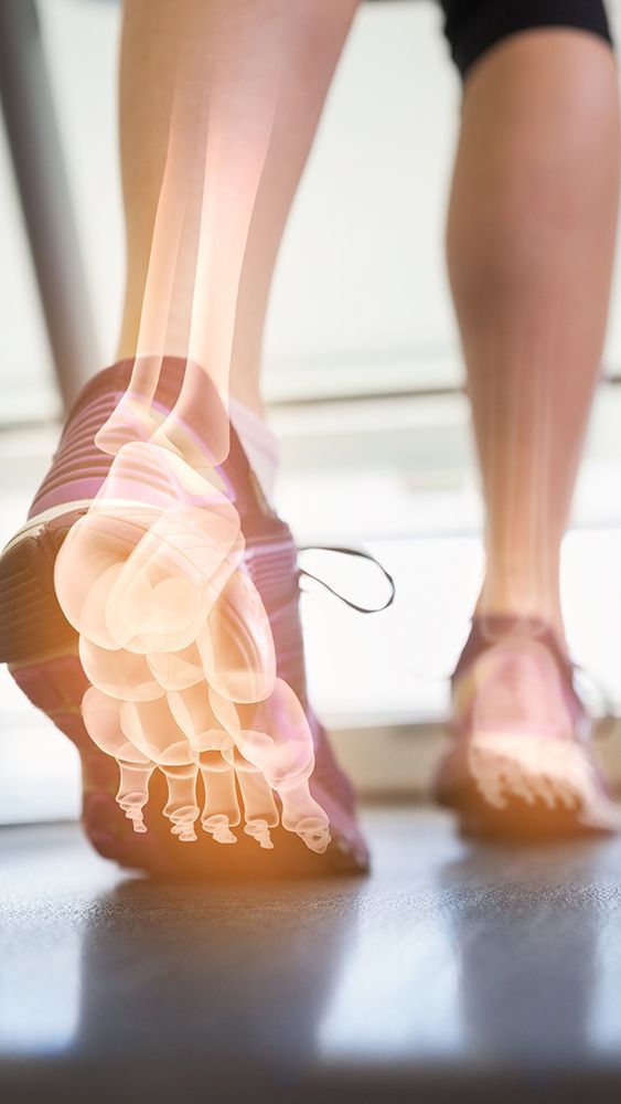 3D Scanning for Orthotics