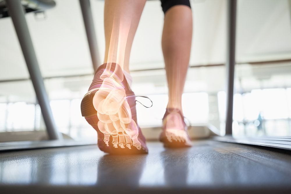 3D Scanning for Orthotics
