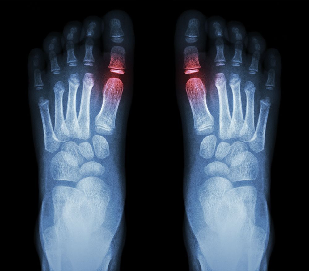 Digital X-Rays